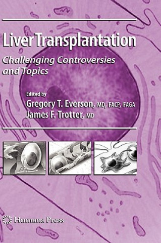 Carte Liver Transplantation Gregory T. Everson