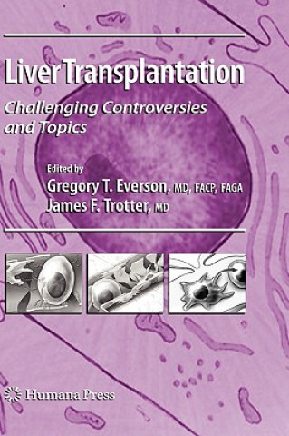 Buch Liver Transplantation Gregory T. Everson