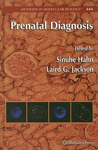 Könyv Prenatal Diagnosis Sinuhe Hahn