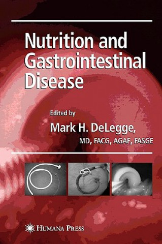 Könyv Nutrition and Gastrointestinal Disease Mark H. DeLegge