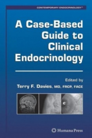 Kniha A Case-Based Guide to Clinical Endocrinology Terry F. Davies