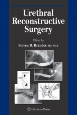 Carte Urethral Reconstructive Surgery Steven B. Brandes
