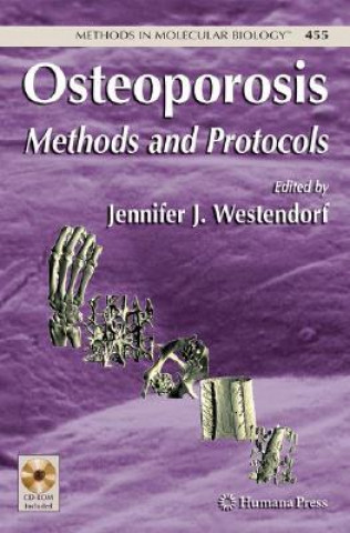 Carte Osteoporosis Jennifer J. Westendorf