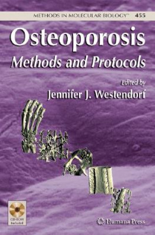 Książka Osteoporosis Jennifer J. Westendorf