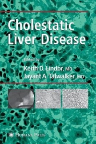 Knjiga Cholestatic Liver Disease Keith D. Lindor