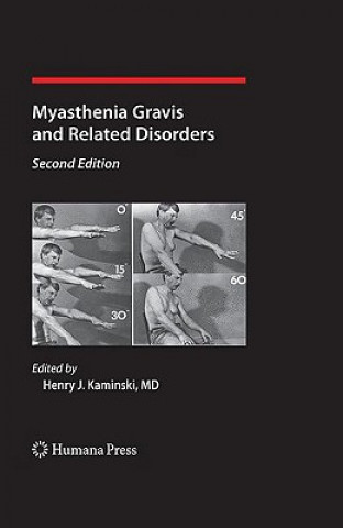 Book Myasthenia Gravis and Related Disorders Henry J. Kaminski