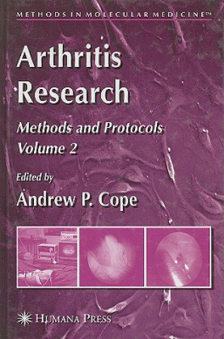 Kniha Arthritis Research Andrew P. Cope