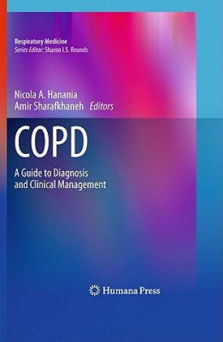Könyv COPD Nicola A. Hanania