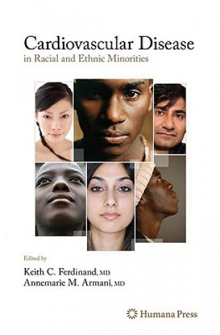 Kniha Cardiovascular Disease in Racial and Ethnic Minorities Keith C. Ferdinand