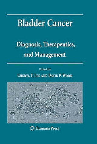 Βιβλίο Bladder Cancer Cheryl T. Lee