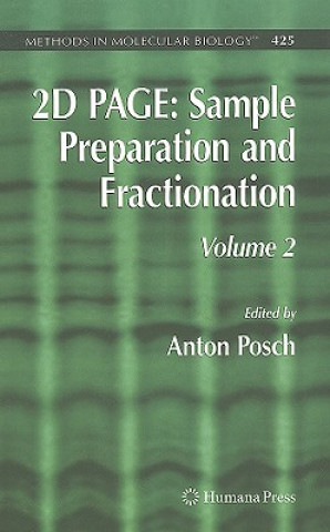 Carte 2D PAGE: Sample Preparation and Fractionation Anton Posch