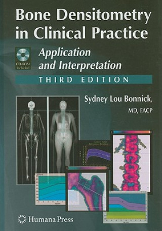 Kniha Bone Densitometry in Clinical Practice Sydney Lou Bonnick