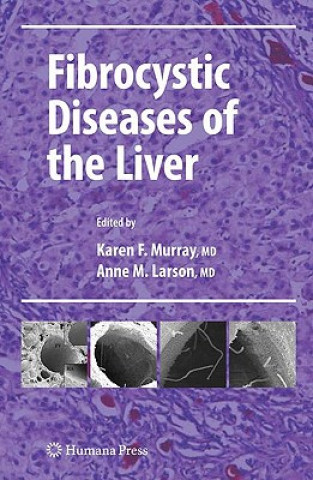 Livre Fibrocystic Diseases of the Liver Karen F. Murray