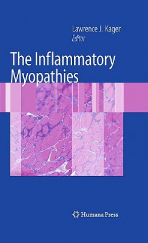 Könyv Inflammatory Myopathies Lawrence Kagen
