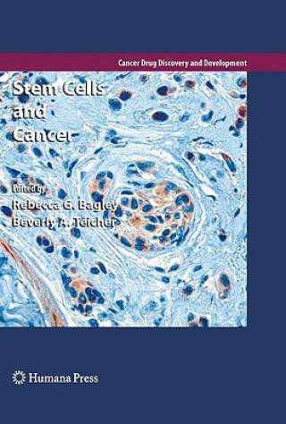 Carte Stem Cells and Cancer Rebecca G. Bagley