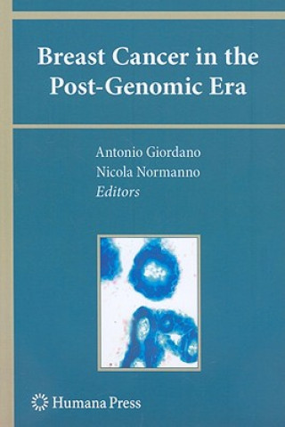 Knjiga Breast Cancer in the Post-Genomic Era Antonio Giordano