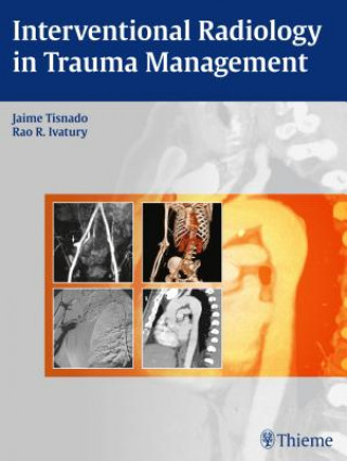 Könyv Interventional Radiology in Trauma Jaime Tisnado