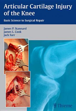Kniha Articular Cartilage Injury of the Knee: Basic Science to Surgical Repair James P. Stannard