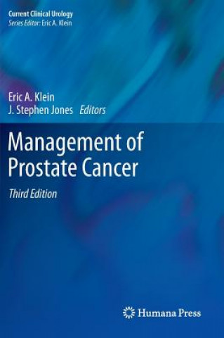 Könyv Management of Prostate Cancer Eric A. Klein