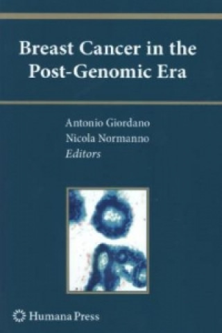 Könyv Breast Cancer in the Post-Genomic Era Antonio Giordano
