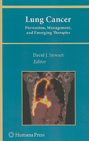 Carte Lung Cancer: David J. Stewart