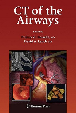 Kniha CT of the Airways Phillip M. Boiselle