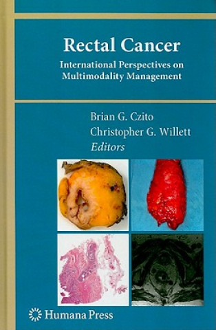 Könyv Rectal Cancer Brian G. Czito