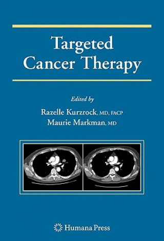 Kniha Targeted Cancer Therapy Razelle Kurzrock