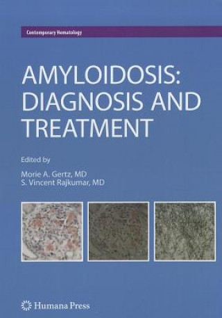 Книга Amyloidosis Morie A. Gertz