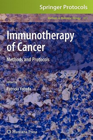 Carte Immunotherapy of Cancer Patricia Yotnda