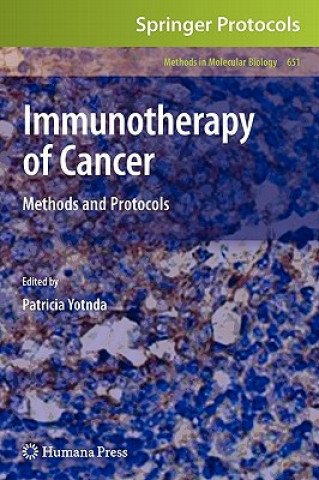 Buch Immunotherapy of Cancer Patricia Yotnda