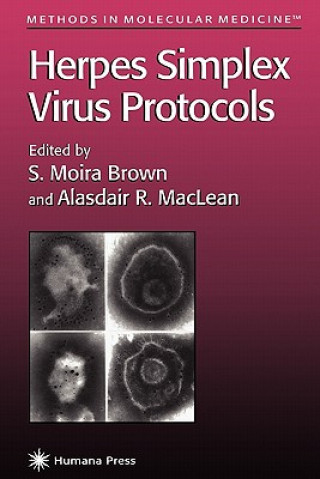 Könyv Herpes Simplex Virus Protocols S. Moira Brown