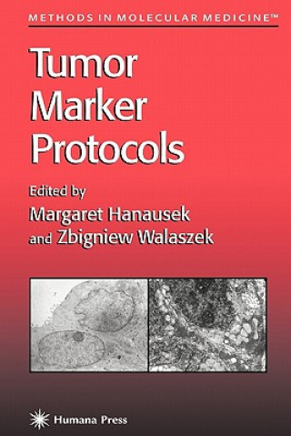 Книга Tumor Marker Protocols Margaret Hanausek