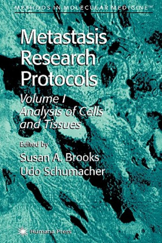 Buch Metastasis Research Protocols Susan A. Brooks