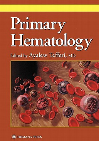 Kniha Primary Hematology Ayalew Tefferi