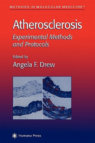 Carte Atherosclerosis Angela F. Drew