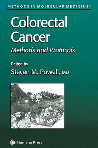 Kniha Colorectal Cancer Steven M. Powell