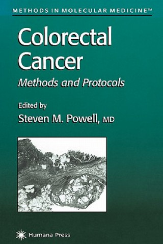 Könyv Colorectal Cancer Steven M. Powell