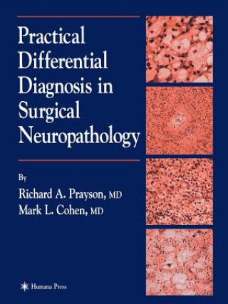 Книга Practical Differential Diagnosis in Surgical Neuropathology Richard A. Prayson