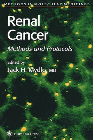 Carte Renal Cancer Jack H. Mydlo