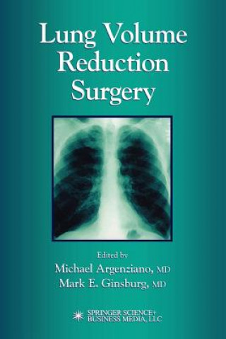 Kniha Lung Volume Reduction Surgery Michael Argenziano