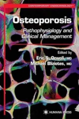 Libro Osteoporosis Eric S. Orwoll