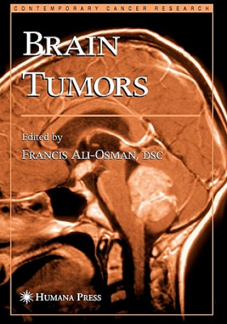 Knjiga Brain Tumors Francis Ali-Osman