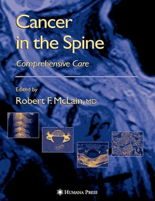 Kniha Cancer in the Spine Robert F. McLain