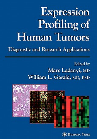 Kniha Expression Profiling of Human Tumors Marc Ladanyi