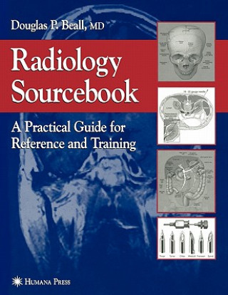 Kniha Radiology Sourcebook Douglas P. Beall