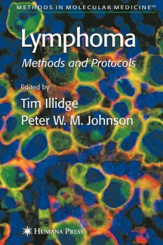 Könyv Lymphoma Tim Illidge