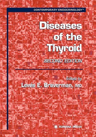 Carte Diseases of the Thyroid Lewis E. Braverman