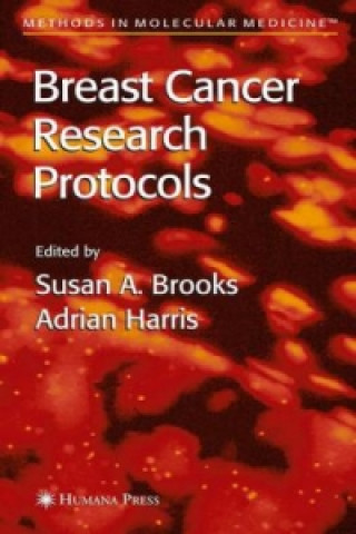 Carte Breast Cancer Research Protocols Susan A. Brooks