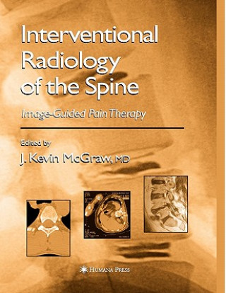 Kniha Interventional Radiology of the Spine J. Kevin McGraw